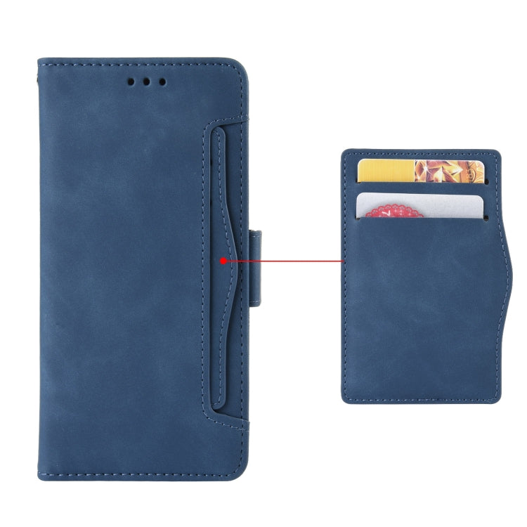For Doogee N40 Pro Skin Feel Calf Pattern Horizontal Flip Leather Case with Holder & Card Slots & Photo Frame(Blue) - More Brand by PMC Jewellery | Online Shopping South Africa | PMC Jewellery | Buy Now Pay Later Mobicred