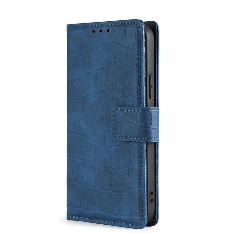 For Doogee X96 Pro Skin Feel Crocodile Magnetic Clasp Leather Phone Case(Blue) - Doogee Cases by PMC Jewellery | Online Shopping South Africa | PMC Jewellery | Buy Now Pay Later Mobicred