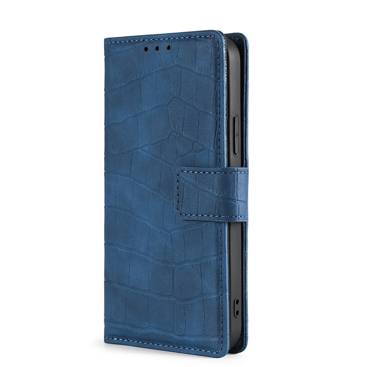 For Blackview A70 Skin Feel Crocodile Magnetic Clasp Leather Phone Case(Blue) - More Brand by PMC Jewellery | Online Shopping South Africa | PMC Jewellery | Buy Now Pay Later Mobicred