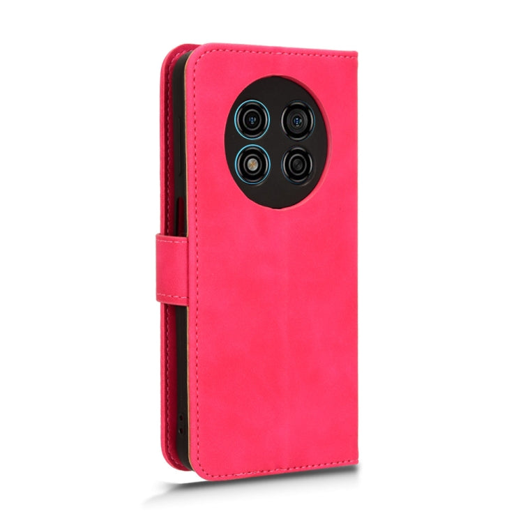 For Ulefone Note 15 Skin Feel Magnetic Flip Leather Phone Case(Rose Red) - Ulefone Cases by PMC Jewellery | Online Shopping South Africa | PMC Jewellery | Buy Now Pay Later Mobicred