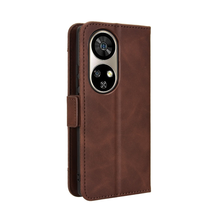 For Ulefone Note 17 Pro Skin Feel Calf Texture Card Slots Leather Phone Case(Brown) - Ulefone Cases by PMC Jewellery | Online Shopping South Africa | PMC Jewellery | Buy Now Pay Later Mobicred