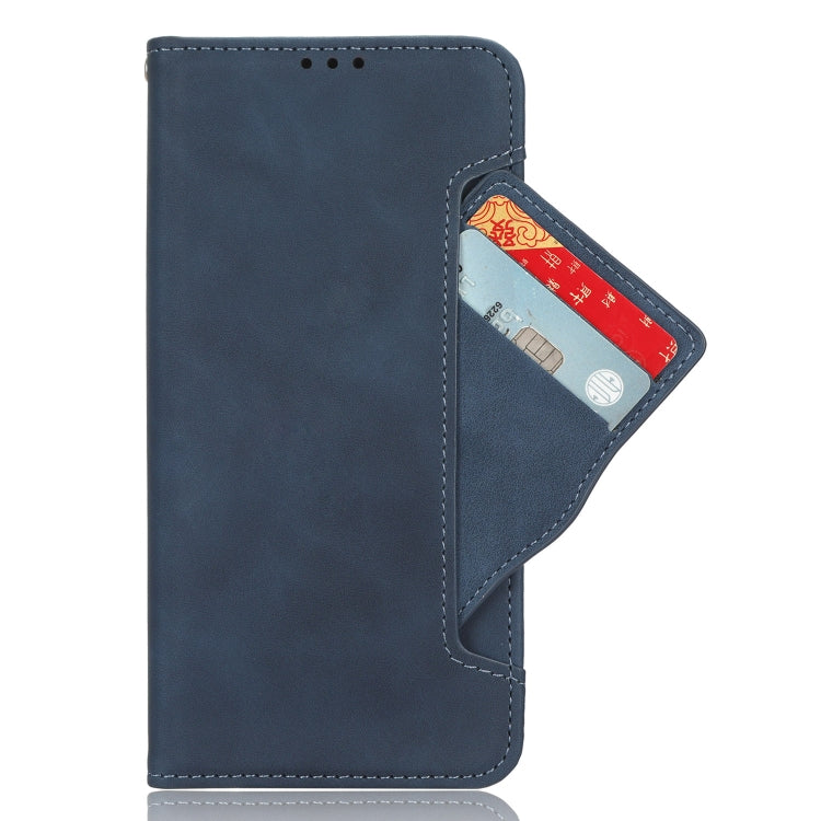 For Doogee X98 Skin Feel Calf Texture Card Slots Leather Phone Case(Blue) - Doogee Cases by PMC Jewellery | Online Shopping South Africa | PMC Jewellery | Buy Now Pay Later Mobicred