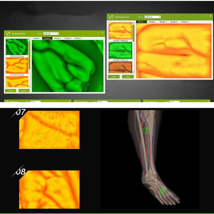 P2-1 Vascular Vein Display Inspection Camera - free shipping - PMC TechLife - Order now!
