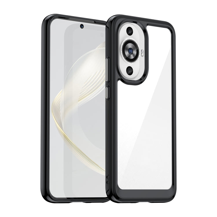 For Huawei Nova 11 Colorful Series Acrylic + TPU Phone Case(Black) - free shipping - PMC TechLife - Order now!